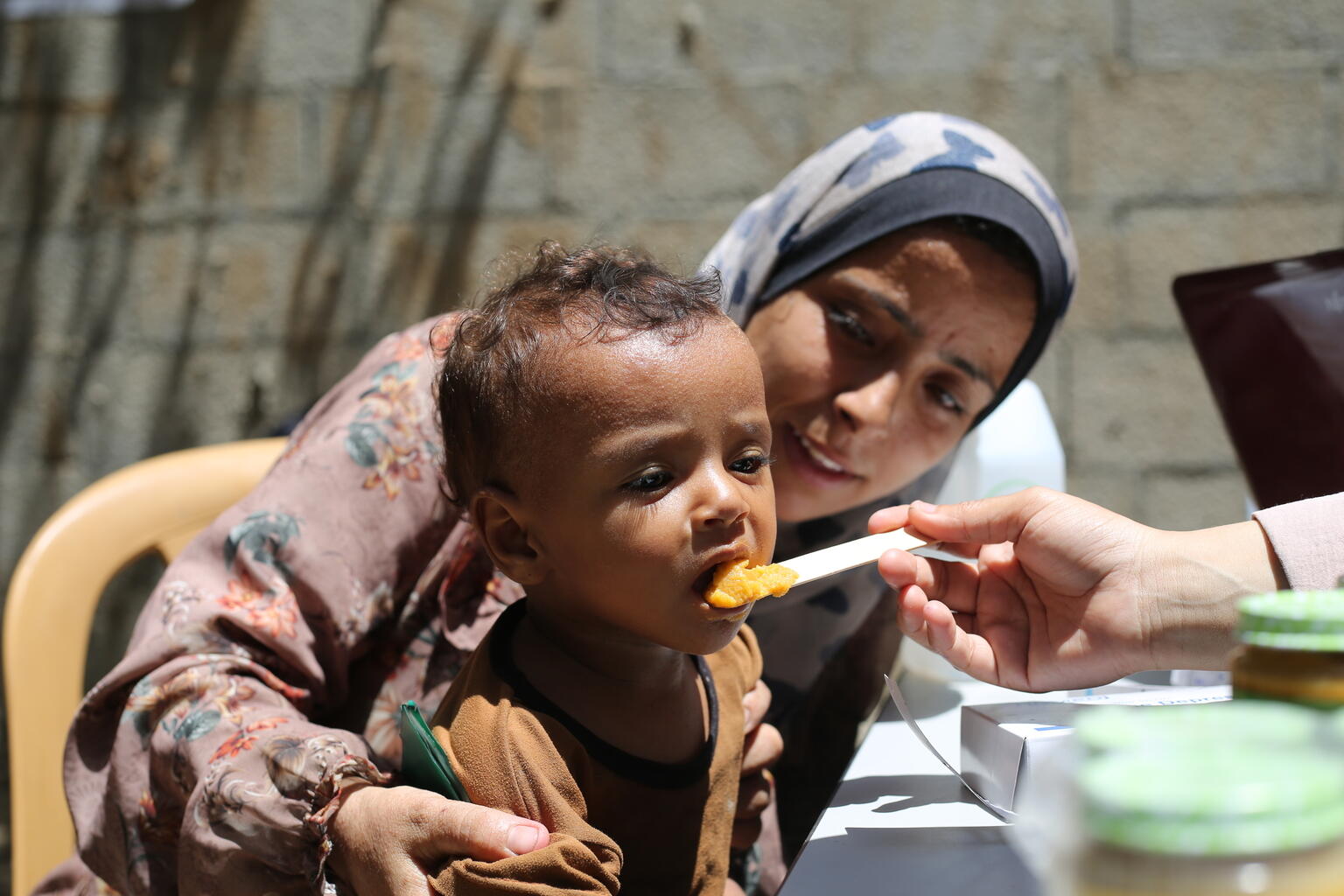 Ein mangelernährtes Kind wird mit therapeutischer Nahrung versorgt.